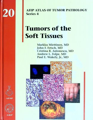 Tumors of the Soft Tissues (AFIP Atlas of Tumor Pathology, Series 4) cover